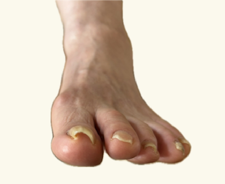 お悩み別の施術