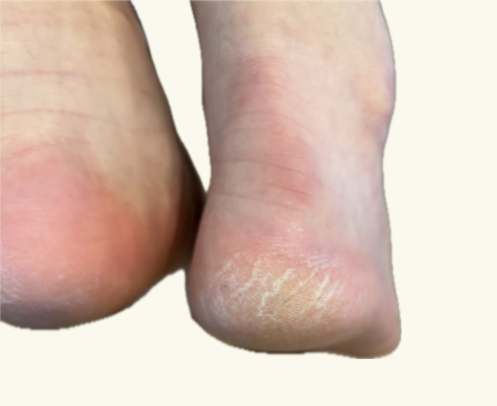 お悩み別の施術