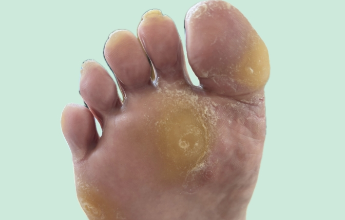 爪再生サポートケア