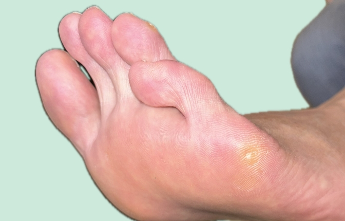 爪再生サポートケア