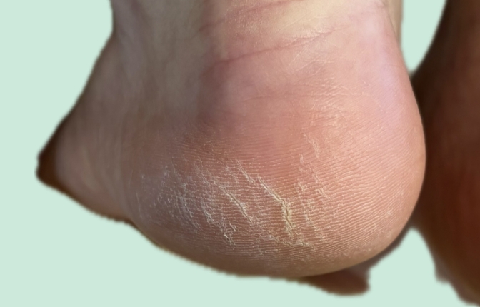 爪再生サポートケア