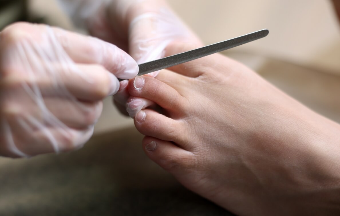 いたわり爪ケア